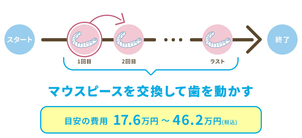 キレイラインがリーズナブルな理由の説明